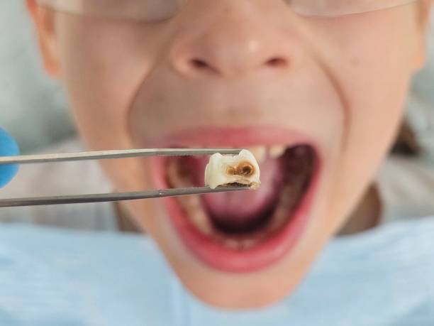 Best Emergency Treatment for Jaw Pain or Injury in Middleton, WI