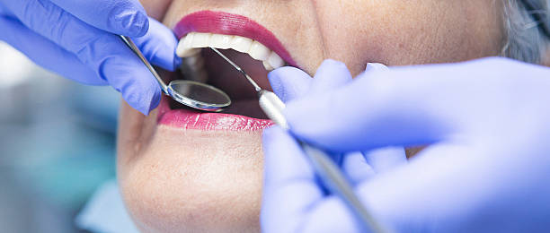 Best Dental Abscess Treatment in Middleton, WI